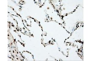 Immunohistochemical staining of paraffin-embedded prostate tissue using anti-DAPK2 mouse monoclonal antibody. (DAPK2 抗体)