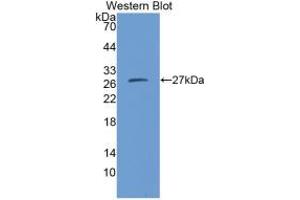 Western blot analysis of the recombinant protein. (CMA1 抗体  (AA 22-247))