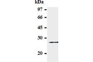 Western blot analysis of GST-SOCS-3 (2-44 a. (SOCS3 抗体  (AA 2-44))