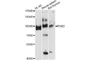 Western blot analysis of extracts of various cell lines, using ITGB2 antibody (ABIN5971200) at 1/1000 dilution. (Integrin beta 2 抗体)