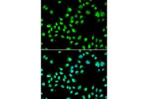 Immunofluorescence analysis of A549 cells using GTF2F2 antibody. (GTF2F2 抗体  (AA 1-249))
