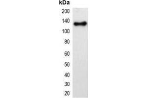 Western blot analysis of over-expressed mOrange-tagged protein in 293T cell lysate. (mOrange Fluorescent Protein 抗体)