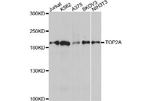 Western blot analysis of extracts of various cell lines, using TOP2A antibody (ABIN5970277) at 1/1000 dilution. (Topoisomerase II alpha 抗体)