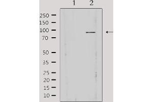 AKAP3 抗体  (Internal Region)