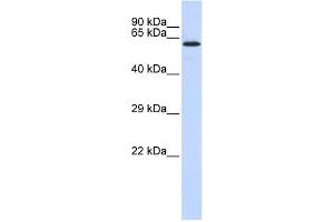 WB Suggested Anti-JMJD4 Antibody Titration:  0. (JMJD4 抗体  (N-Term))