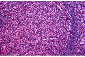 Human Tonsil: Formalin-Fixed, Paraffin-Embedded (FFPE) (CD48 抗体  (AA 1-170))