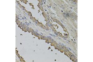 Immunohistochemistry of paraffin-embedded human prostate using FMR1NB antibody (ABIN5972990) at dilution of 1/100 (40x lens). (FMR1NB 抗体)