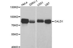 Western Blotting (WB) image for anti-Caldesmon 1 (CALD1) antibody (ABIN1876554) (Caldesmon 抗体)