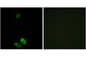 Immunofluorescence analysis of A549 cells, using AKR1CL1 Antibody. (AKR1CL1 抗体  (AA 80-129))