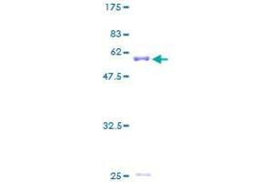 Image no. 1 for Aminoacyl tRNA Synthetase Complex-Interacting Multifunctional Protein 1 (AIMP1) (AA 1-312) protein (GST tag) (ABIN1319319) (AIMP1 Protein (AA 1-312) (GST tag))