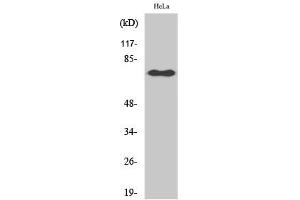 Western Blotting (WB) image for anti-Nuclear Factor-kB p65 (NFkBP65) (pSer529) antibody (ABIN5961223) (NF-kB p65 抗体  (pSer529))