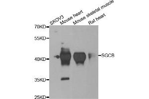 Western blot analysis of extracts of various cell lines, using SGCB antibody. (SGCB 抗体)