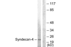 Western Blotting (WB) image for anti-Syndecan 4 (SDC4) (Ser179) antibody (ABIN1848042) (SDC4 抗体  (Ser179))