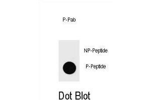 Dot blot analysis of Phospho-PTEN- Antibody Phospho-specific Pab g on nitrocellulose membrane. (PTEN 抗体  (pThr401))