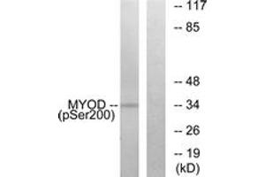 Western blot analysis of extracts from Jurkat cells treated with Ca+ 40nM 30', using MYOD (Phospho-Ser200) Antibody. (MYOD1 抗体  (pSer200))