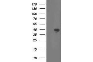 HEK293T cells were transfected with the pCMV6-ENTRY control (Left lane) or pCMV6-ENTRY RLBP1 (Right lane) cDNA for 48 hrs and lysed. (RLBP1 抗体)