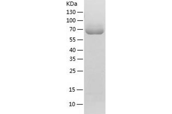 Moesin Protein (MSN) (AA 1-577) (His tag)