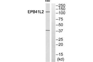 Western Blotting (WB) image for anti-erythrocyte Membrane Protein Band 4.1-Like 2 (EPB41L2) (Internal Region) antibody (ABIN1850881) (EPB41L2 抗体  (Internal Region))