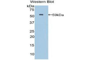 Western Blotting (WB) image for anti-Moesin (MSN) (AA 354-577) antibody (ABIN1859888) (Moesin 抗体  (AA 354-577))