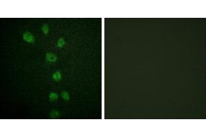 P-peptide - +Immunofluorescence analysis of HepG2 cells, using GATA4 (Phospho-Ser105) antibody. (GATA4 抗体  (pSer105))