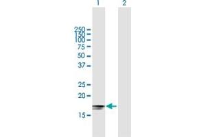 Western Blot analysis of IFNA2 expression in transfected 293T cell line by IFNA2 MaxPab polyclonal antibody. (IFNA2 抗体  (AA 1-188))