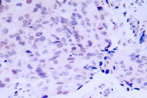Image no. 2 for anti-Retinoblastoma 1 (RB1) antibody (ABIN271803) (Retinoblastoma 1 抗体)