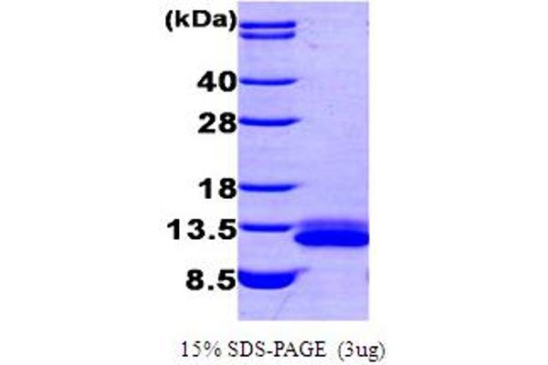 CXCL12 Protein (AA 22-93) (His tag)