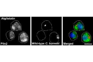 Immunostaining (ISt) image for anti-Perilipin 2 (PLIN2) (AA 1-29), (N-Term) antibody (ABIN285650)