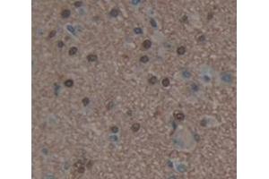 IHC-P analysis of Human Tissue, with DAB staining. (HDAC9 抗体  (AA 23-343))