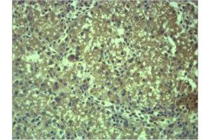 Immunohistochemistry (IHC) analysis of paraffin-embedded Mouse Liver Tissue using EPG5 Polyclonal Antibody. (EPG5 抗体)
