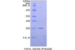 SDS-PAGE analysis of Mouse NME2 Protein. (NME2 蛋白)