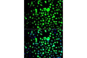 Immunofluorescence analysis of A549 cells using ZBTB25 antibody (ABIN5975302). (ZBTB25 抗体)
