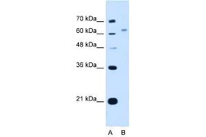 WSCD2 antibody used at 1. (WSCD2 抗体  (C-Term))