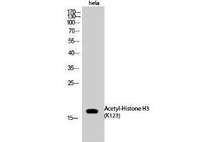 Western Blotting (WB) image for anti-Histone 3 (H3) (acLys123) antibody (ABIN3188007) (Histone 3 抗体  (acLys123))