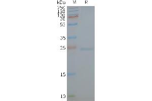 Human -Nanodisc, Flag Tag on SDS-PAGE (Caveolin-1 蛋白)