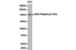Western Blotting (WB) image for anti-V-Erb-A erythroblastic Leukemia Viral Oncogene Homolog 4 (Avian) (ERBB4) (pTyr1284) antibody (ABIN1870170) (ERBB4 抗体  (pTyr1284))