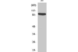 Western Blot analysis of various cells using IL-4Rα Polyclonal Antibody diluted at 1:2000. (IL4 Receptor 抗体)