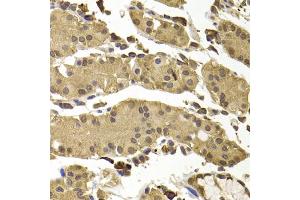 Immunohistochemistry of paraffin-embedded human stomach using SETD5 antibody (ABIN5974406) at dilution of 1/100 (40x lens). (SETD5 抗体)