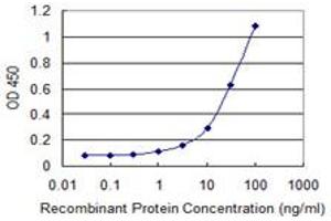 Detection limit for recombinant GST tagged TK1 is 0. (TK1 抗体  (AA 1-234))