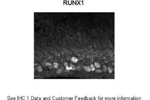 Sample Type : Mouse, post-natal day (p) 0 retinal ganglion cells Primary Antibody Dilution : 1:1500 Secondary Antibody : Donkey anti rabbit IgG Alexa 594 Secondary Antibody Dilution : 1:1000 Gene Name : RUNX1  Submitted by : Anonymous (RUNX1 抗体  (Middle Region))