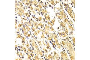 Immunohistochemistry of paraffin-embedded human stomach using CASP3 antibody at dilution of 1:100 (x400 lens). (Caspase 3 抗体)