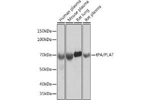 Western blot analysis of extracts of various cell lines, using tPA/tPA/PLAT Rabbit mAb (ABIN1678727, ABIN3018699, ABIN3018700 and ABIN7101650) at 1:1000 dilution. (PLAT 抗体)