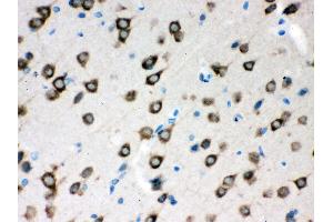 Anti- SMN1/2 Picoband antibody,IHC(P) IHC(P): Rat Brain Tissue (SMN1 / SMN2 (AA 22-52), (N-Term) 抗体)