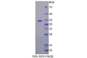 Image no. 1 for Chymotrypsin-Like Elastase Family, Member 2A (CELA2A) (AA 17-271) protein (His tag) (ABIN4990185) (CELA2A Protein (AA 17-271) (His tag))