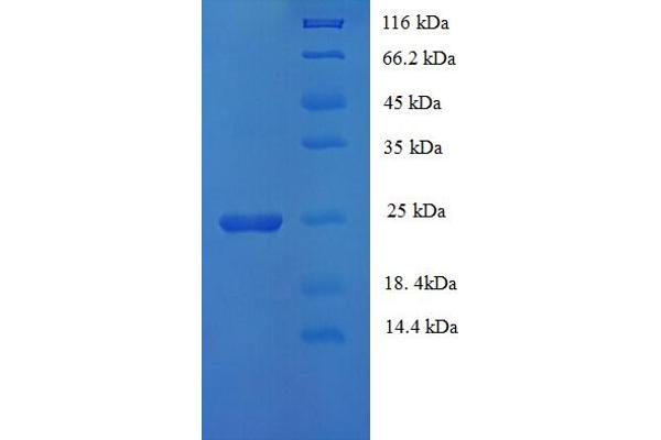 HLA-DQA1 Protein (AA 24-213, Extracellular) (His tag)