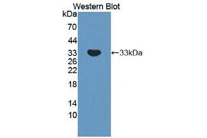 Figure. (Phospholipase C beta 2 抗体  (AA 1-250))