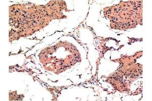 Immunohistochemical analysis of paraffin-embedded Rat Testis Tissue using Bax Mouse mAb diluted at 1:200. (BAX 抗体)