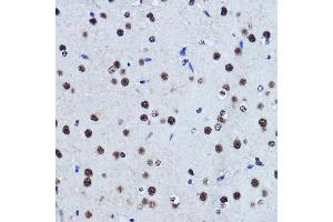 Immunohistochemistry of paraffin-embedded rat brain using TDP-43/TARDB Rabbit pAb  at dilution of 1:500 (40x lens). (TARDBP 抗体  (AA 1-100))