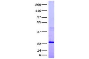 Validation with Western Blot (INHBA 蛋白)