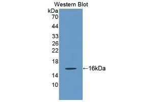 Detection of Recombinant KRT2, Rat using Polyclonal Antibody to Keratin 2 (CK2) (Keratin 2 抗体  (AA 508-685))
